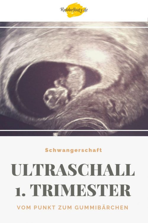 Zweiter Arzttermin in der Schwangerschaft Rubbelbatz