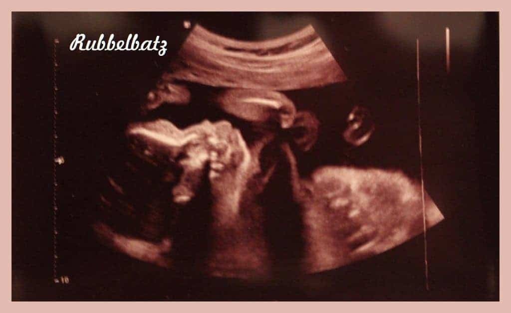 Ultraschallbild von Feindiagnostik